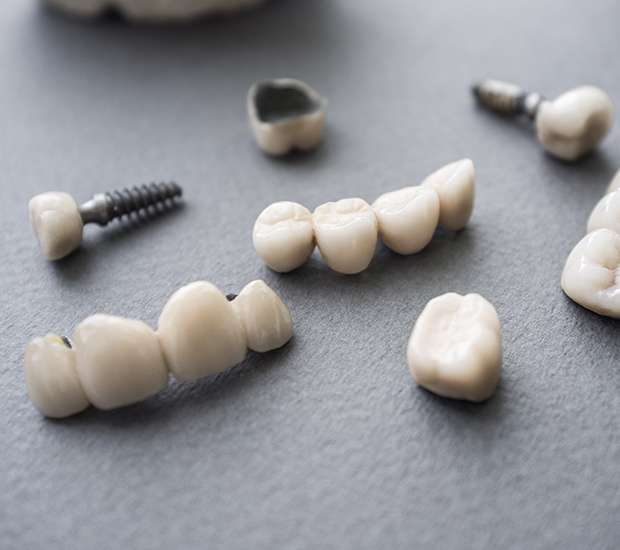 St Petersburg The Difference Between Dental Implants and Mini Dental Implants
