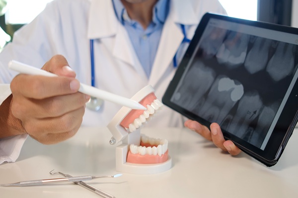 Tooth Replacement Options After A Tooth Extraction
